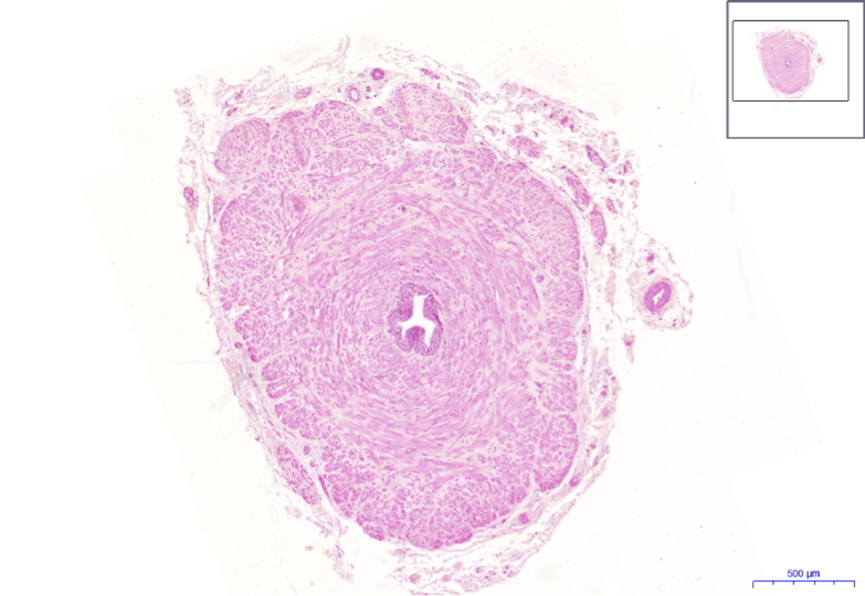 soubor-ductus-deferens-he-2-4x-jpeg-wikiskripta