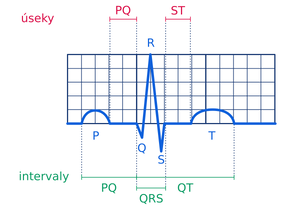 Ekg-schema.svg