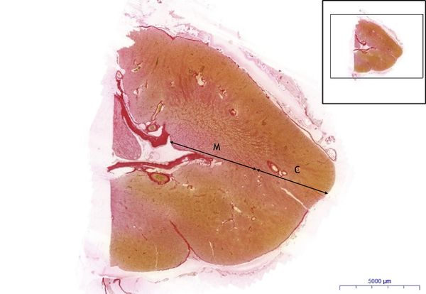 Ledvina-Kidney, WvG 0,4x.jpeg