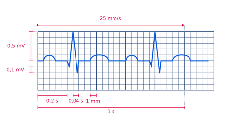 ParametryEKG.svg